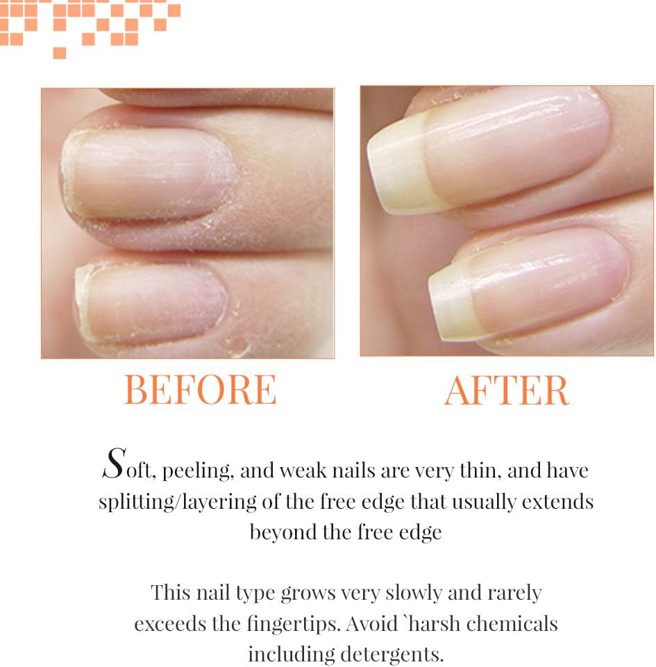 Nail Tek Nail Tek Foundation Ii - Foundation Ii , 0.15 pounds