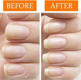 [Nail Tek] New Restore Damaged Nails Kit