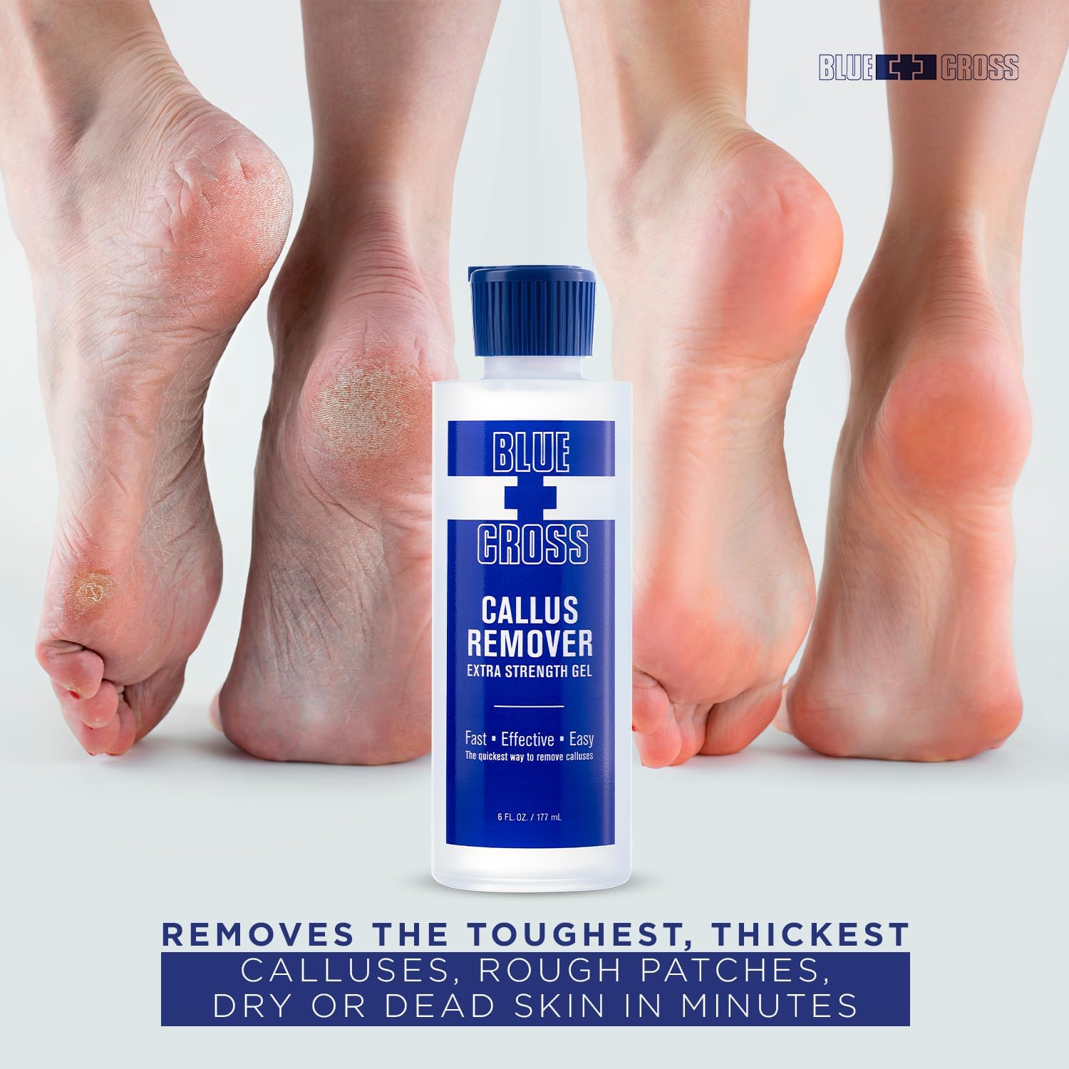 Blue Cross Extra Strength Callus Remover Gel for Heel or Feet 6oz/32oz