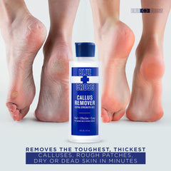 Blue Cross Extra Strength Callus Remover Gel for Heel or Feet 6oz/32oz
