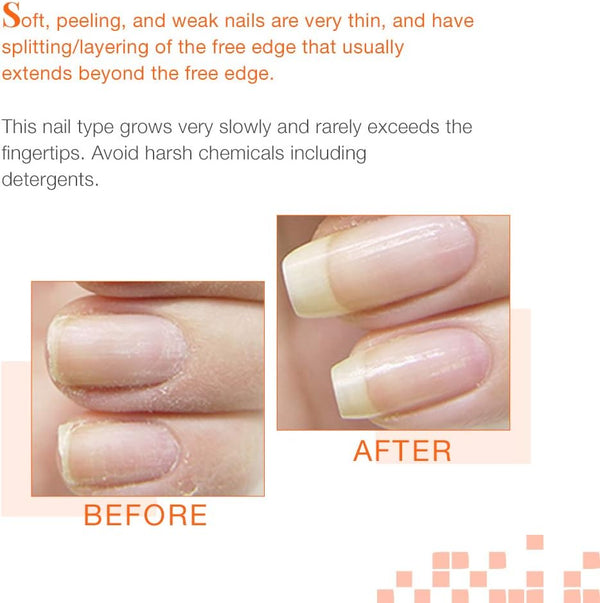 NailTek Intensive Therapy 2 Strengthener 15ml