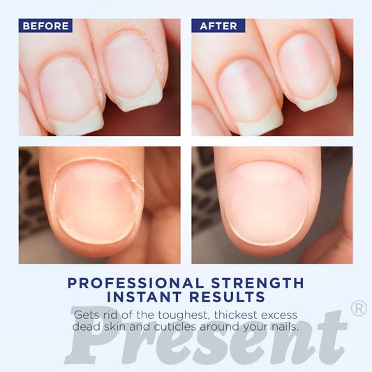 [Present] Cuticle remover (2OZ/59ml)